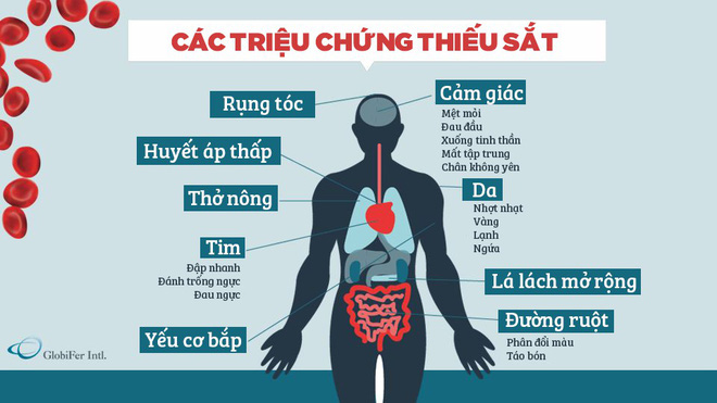  Nếu có các triệu chứng này, rất có thể bạn đang bị thiếu sắt 